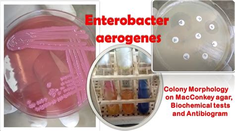 enterobacter macconkey|Enterobacter Infections .